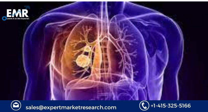 Thoracic Surgery Market