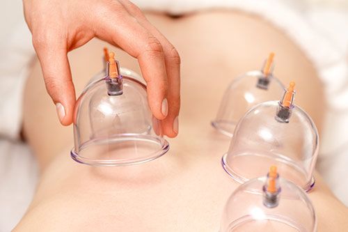 Hijama in Dubai