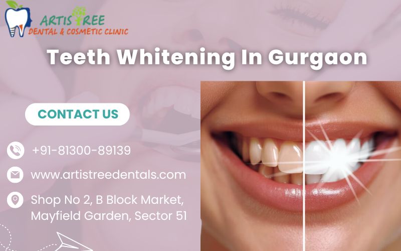 Teeth Whitening In Gurgaon