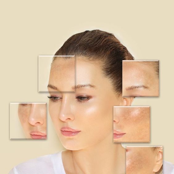 Anti-Aging Treatments in Dubai