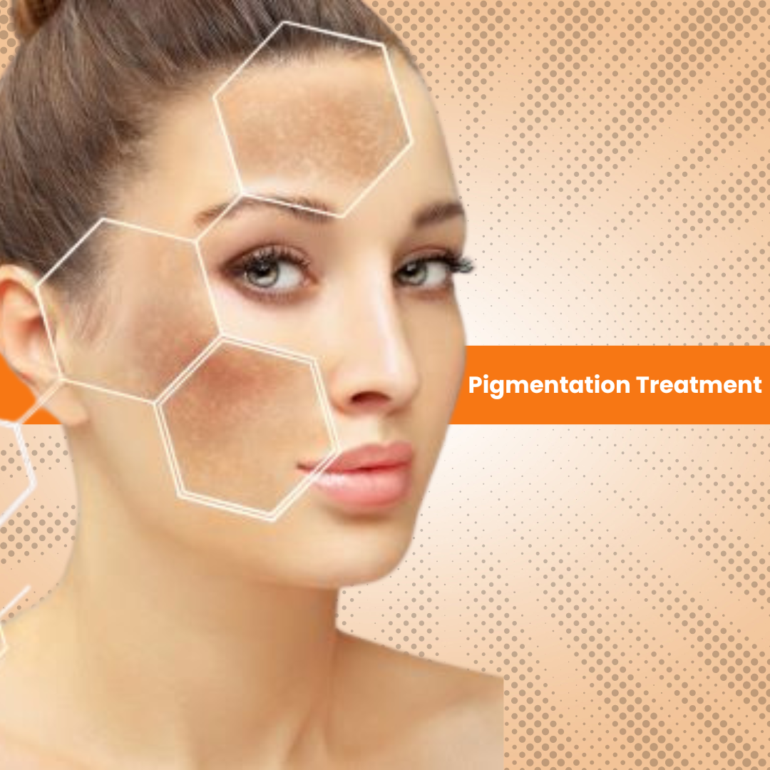 Pigmentation Treatment Kit