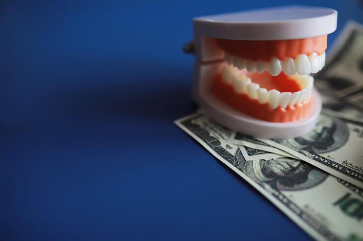 dental implants cost lafayette la