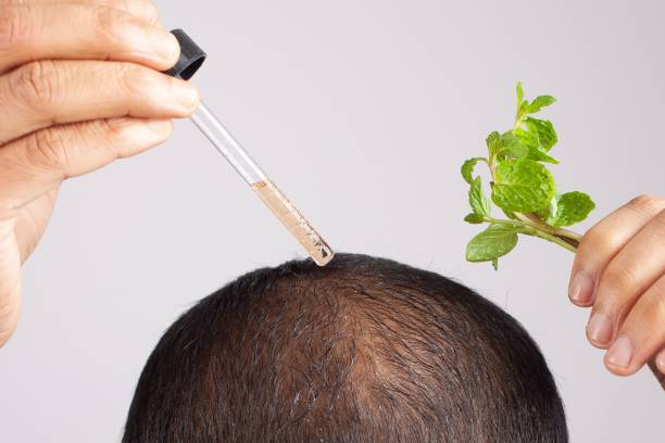 Scalp Micropigmentation in Abu Dhabi