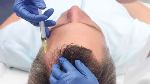 Stem Cell Hair Transplant in Abu Dhabi