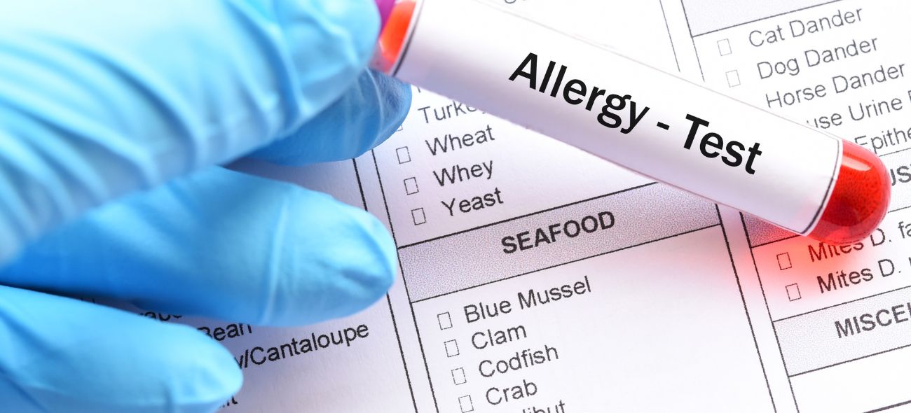 Allergy Testing in London with Private Clinics