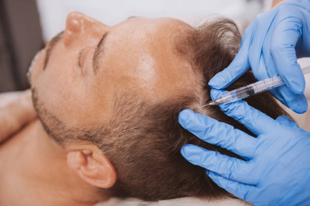 PRP hair treatment in Abu Dhabi