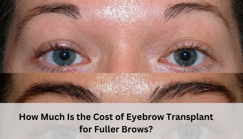 cost of eyebrow transplant