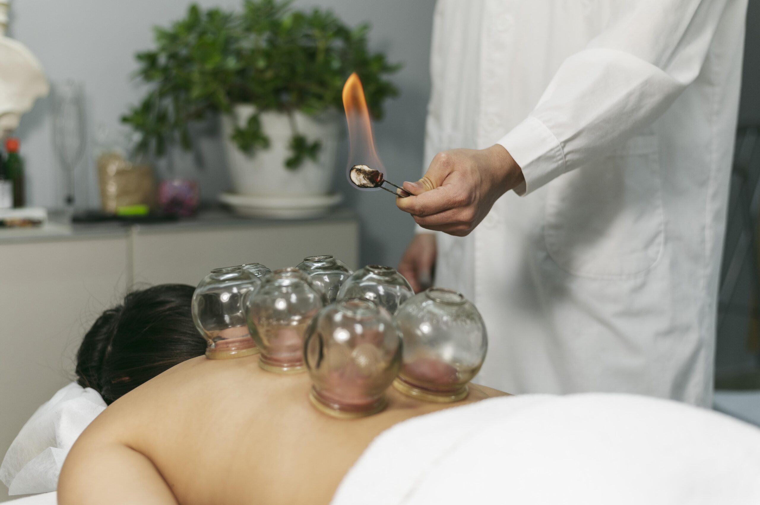 Cupping therapy in Las Vegas