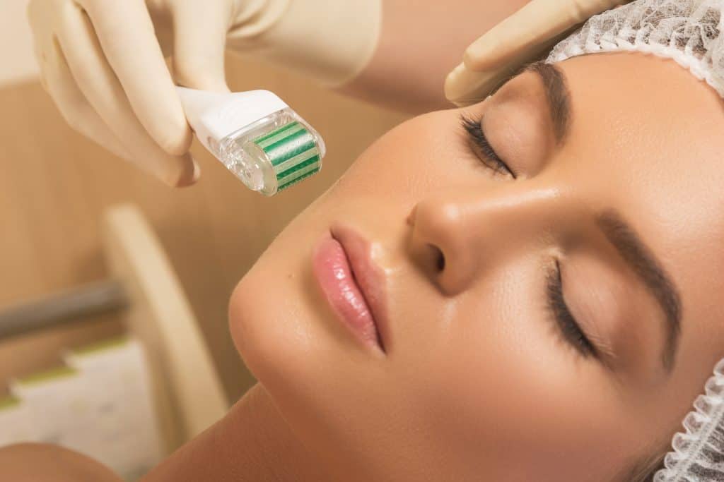 Microneedle Treatment